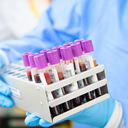 Exámenes de Laboratorio de Tiroides T3, T4, T4 Libre y TSH por $25 en Laboratorio Panamá Lab