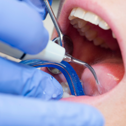 Limpieza Dental Completa por solo $14 en Clínica Dental Metro