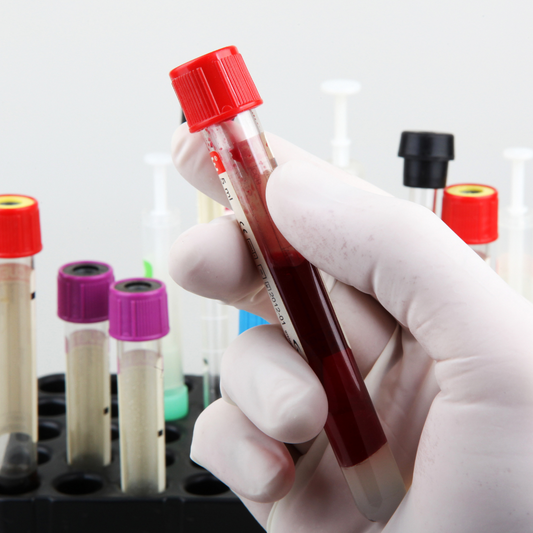 Exámenes Médicos Generales (Hemograma, Glucosa, Colesterol, Triglicéridos y +10 exámenes más) por $19.99 en Ventura Lab