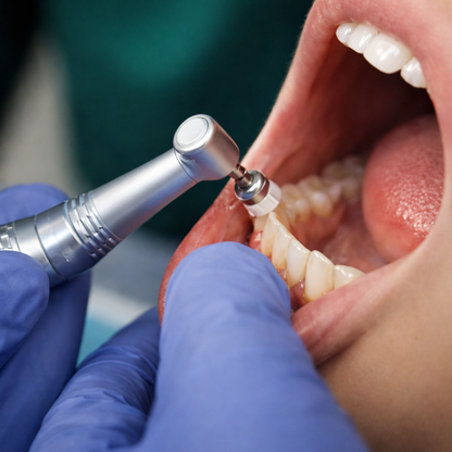 Limpieza Dental + Pulido Coronal + Aplicación de Flúor por solo $15 en We Care Smile Studio