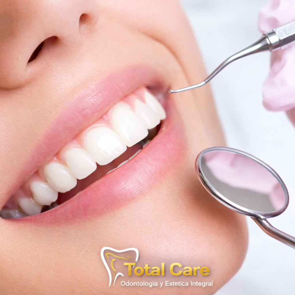 Limpieza Dental Completa + Revisión con Cámara Intraoral + Evaluación odontológica por $20 en Total Care
