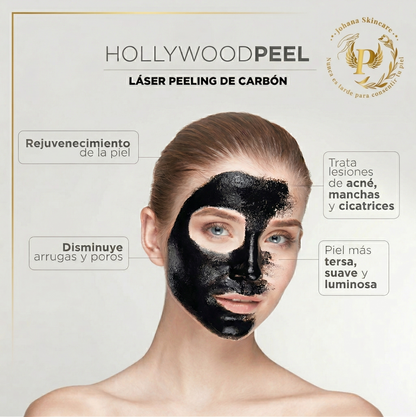 Hollywood Peel con Carbón Activado + Láser para Glow Inmediato desde $19.50 en Johana Skincare