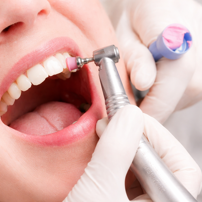 Limpieza Dental Completa + Revisión con Cámara Intraoral + Evaluación odontológica por $20 en Total Care