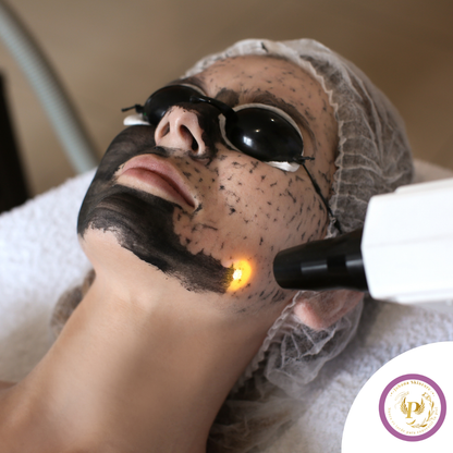 Hollywood Peel con Carbón Activado + Láser para Glow Inmediato desde $19.50 en Johana Skincare