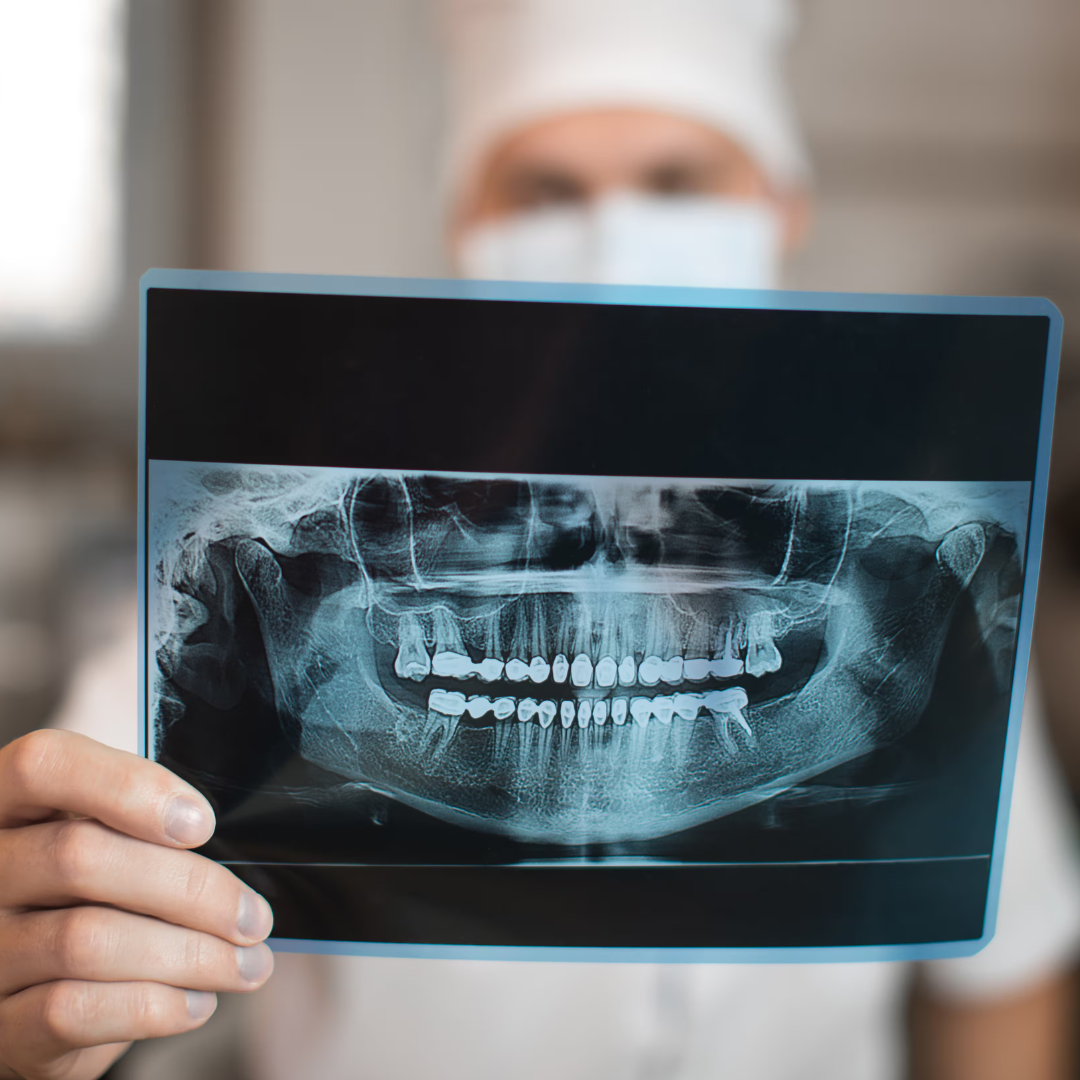 Plan de ortodoncia + Evaluación + Montaje de Brackets +Limpieza Dental + Radiografía Panorámica por $50 en Clínica Dental Metro