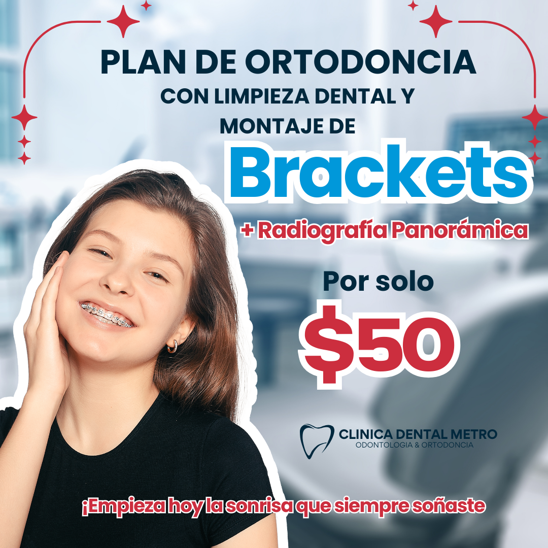 Plan de ortodoncia + Evaluación + Montaje de Brackets +Limpieza Dental + Radiografía Panorámica por $50 en Clínica Dental Metro